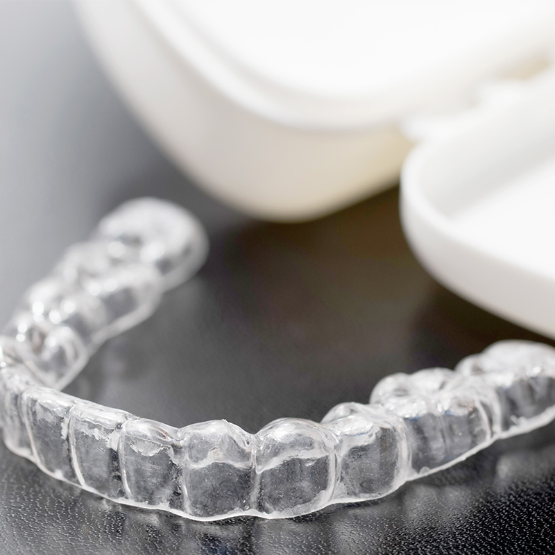 マウスピース製作